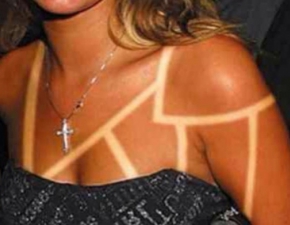 Sunburn art, sunburn tattoo: nowa, bardzo niebezpieczna moda 