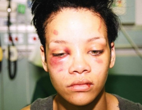 Szokujce wyznanie Chrisa Browna. To Rihanna sprowokowaa bjk?