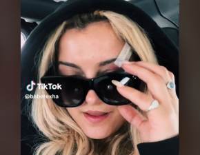 Bebe Rexha pokazaa twarz po uderzeniu telefonem. Nie wyglda to najlepiej FOTO