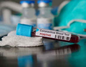 Pierwszy przypadek koronawirusa w Polsce potwierdzony