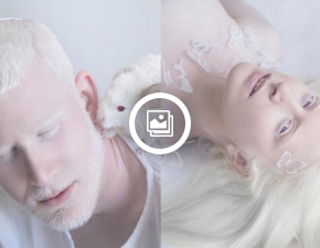 Hipnotyzujce pikno albinizmu w wyjtkowej sesji zdjciowej