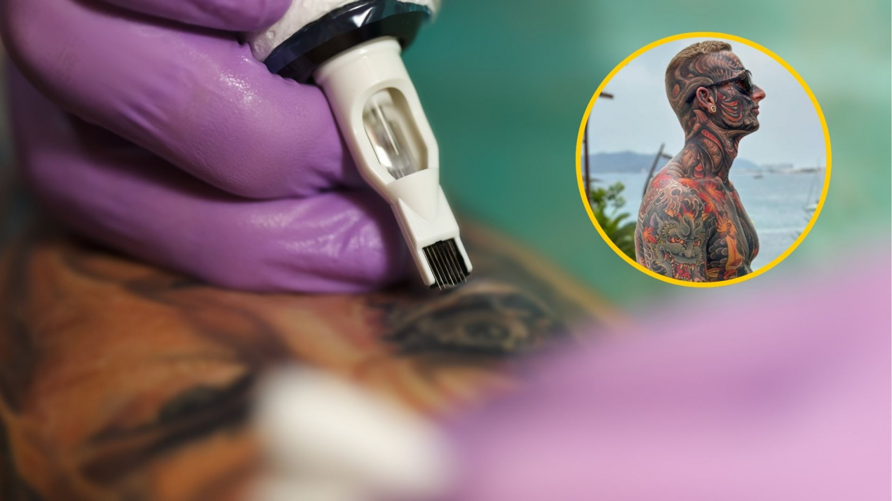 Tatuaże pokryły 95% jego ciała. Teraz zaczął je usuwać i pokazał efekty metamorfozy