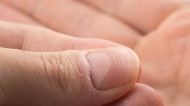 Eksperci mówią wprost, kiedy linie na paznokciach..