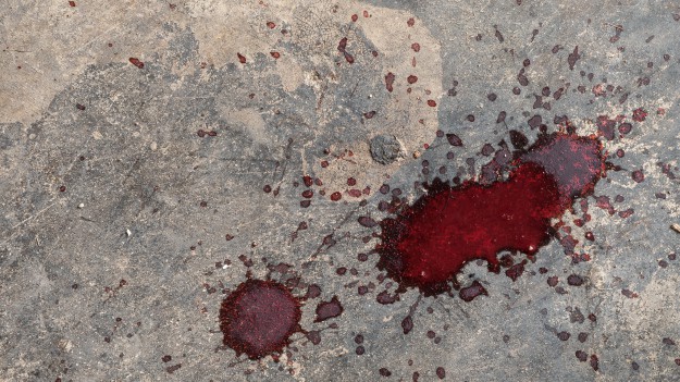 RMF Extra: Wokalista disco polo ofiarą brutalnego pobicia. Ma uszkodzoną czaszkę. "Sprawca w zamiarze miał mnie zabić"