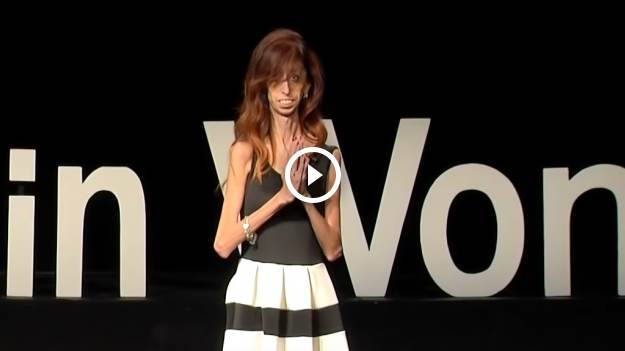 RMF Extra: Nazwano ją "najbrzydszą kobietą na świecie". Dziś jest inspiracją dla milionów [FOTO] 