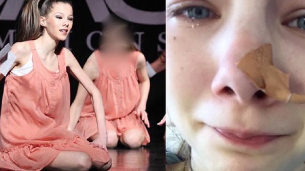 RMF Extra: Chorowała na anoreksję i mogła umrzeć! Dziś jest modelką!