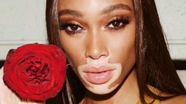 RMF Extra: Nowy aniołek "Victoria's Secret": Na co choruje modelka?