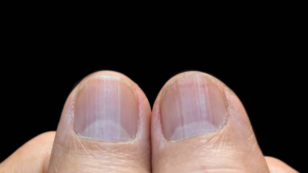 Mało kto wie, jakie funkcje pełni lunula..