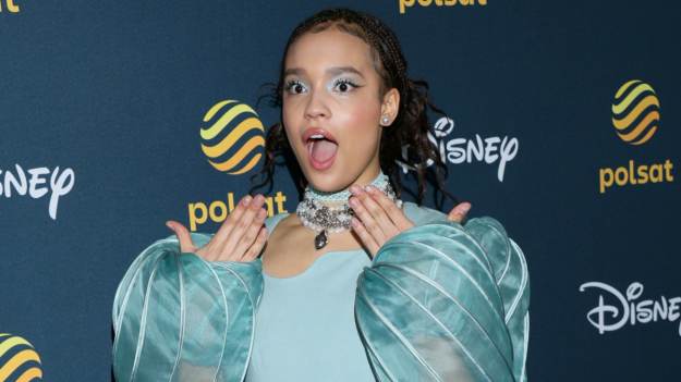 RMF Extra: Sara James przeszła metamorfozę! Oto jej nowe zęby [FOTO]