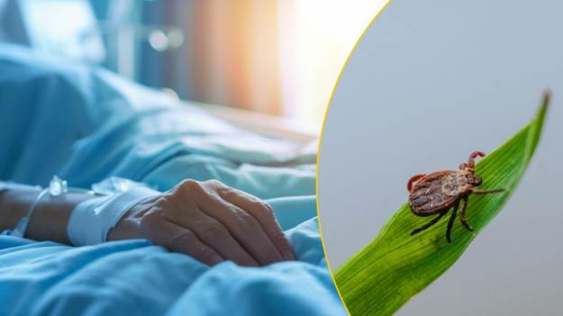 RMF Extra: To pierwsze objawy kleszczowego zapalenia mózgu. Zaczyna się jak grypa, kończy w szpitalu