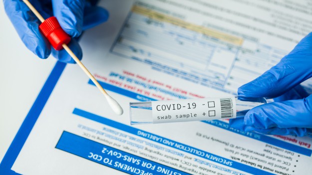 RMF Extra: Test na koronawirusa. Kiedy wykonać? Jak się przygotować? Jak interpretować wyniki badań?