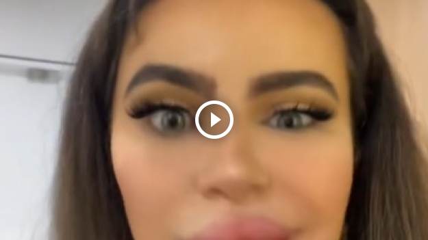 RMF Extra: Chciała pomniejszyć usta. Wyszły 3 razy większe. "Jak opony Michelin" [WIDEO] 