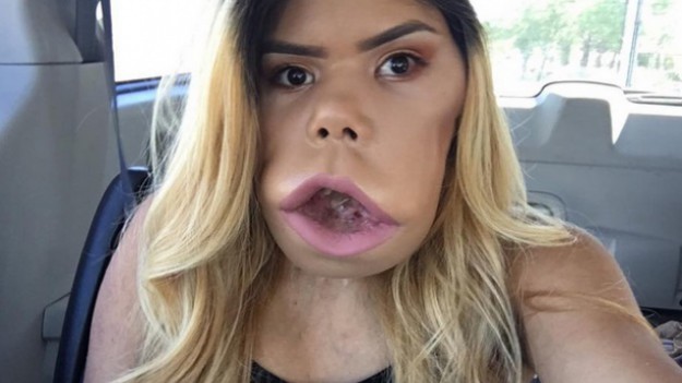 RMF Extra: Mimo rzadkiej choroby jest makijażową guru dla milionów kobiet