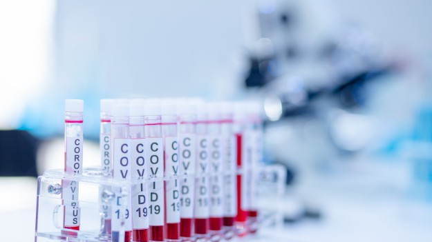 RMF Extra: Padł zatrważający rekord zgonów. Znów ponad 27 tys. nowych przypadków koronawirusa w Polsce