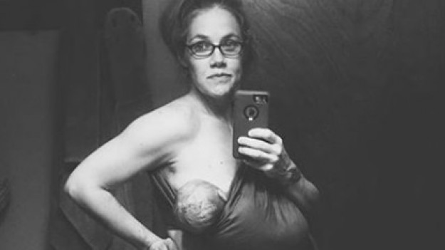 RMF Extra: Kobiece ciało 24 godziny po porodzie 