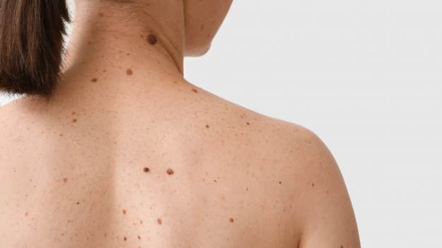 RMF Extra: Trzy niepokojące objawy na skórze. Masz je? Powinieneś udać się do lekarza!