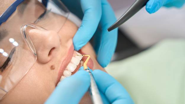 RMF Extra: Jak skutecznie pozbyć się kamienia nazębnego? Ekspertka radzi, co naprawdę działa