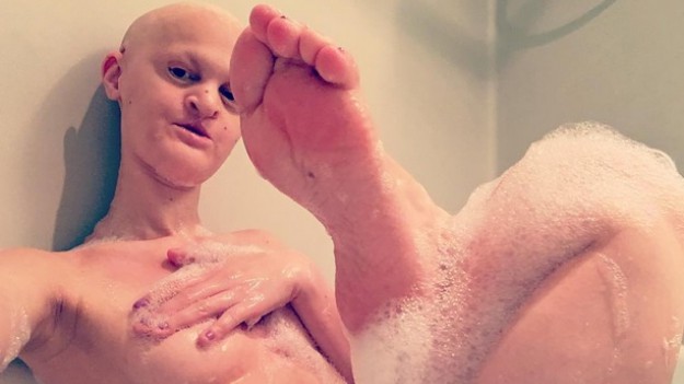 RMF Extra: Modelka z wadami genetycznymi podbija świat! 