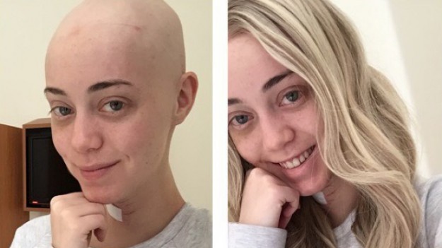 RMF Extra: Modelka publikuje zdjęcie po jednej z prób samobójczych: Kryje się za tym ważny przekaz