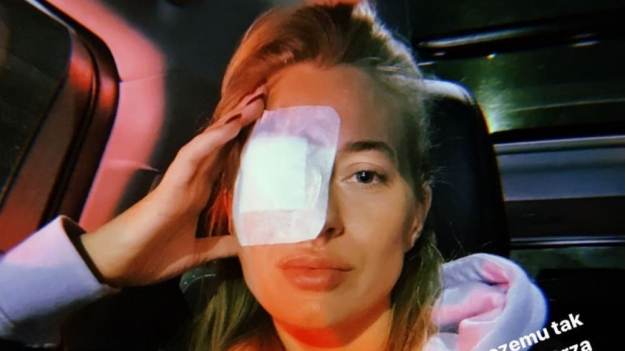 RMF Extra: Marcelina Zawadzka dokleiła sobie rzęsy. Skończyła w szpitalu. Teraz ostrzega [ZDJĘCIA]