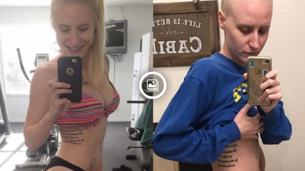 RMF Extra: Tak nowotwór zmienił ciało zdrowej, wysportowanej kobiety