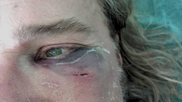 RMF Extra: Polski rockman brutalnie pobity po koncercie. Wstrząsające zdjęcia