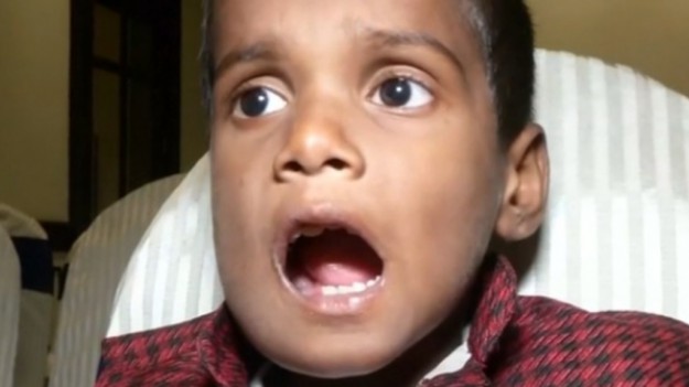 RMF Extra: 7-latek miał 526 dodatkowych zębów! Niesamowite! 