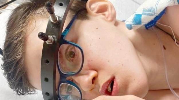 RMF Extra: Milion złotych potrzebny na już! Alek musi przejść pilną operację w USA [ZBIÓRKA]