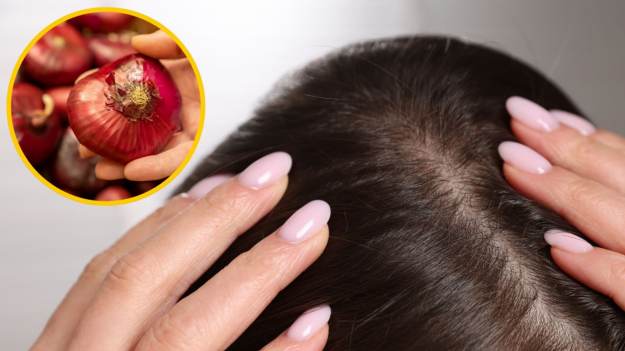 RMF Extra: Wcierka z cebuli to najlepszy sposób na porost włosów? Ekspertka reaguje na popularny trend: „to nie ma sensu”
