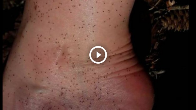 RMF Extra: Uwaga na gniazda i larwy kleszczy! Są równie niebezpieczne co dorosłe osobniki