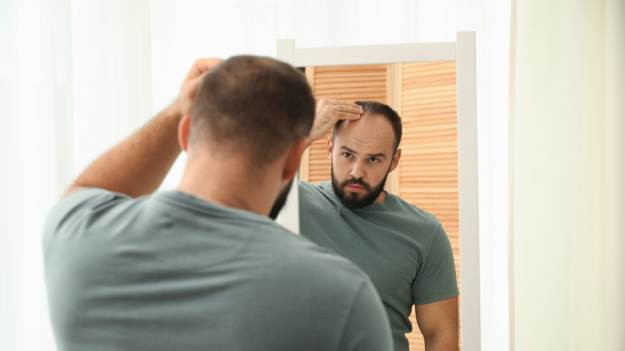 RMF Extra: Łysienie nie będzie już problemem. Japońscy naukowcy z przełomowym odkryciem 