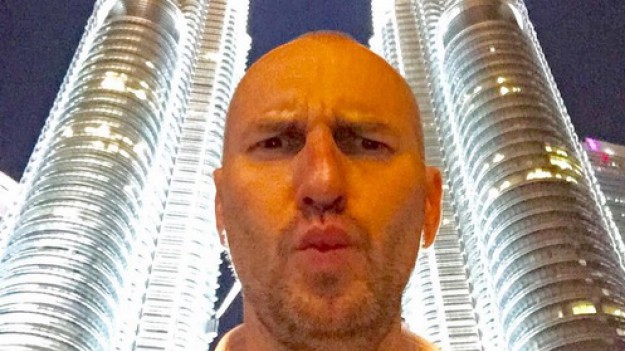 RMF Extra: Doktor Gojdź przeszczepił włosy! 