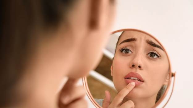 RMF Extra: Pękające usta w zimie – co robić?