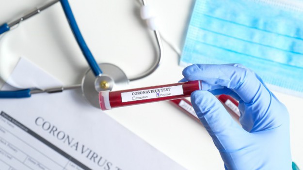 RMF Extra: Mniej nowych przypadków koronawirusa. Ministerstwo Zdrowia opublikowało raport