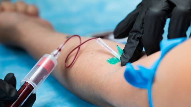 RMF Extra: „Złota krew” – najrzadsza na świecie. Ma ją niespełna 50 osób 