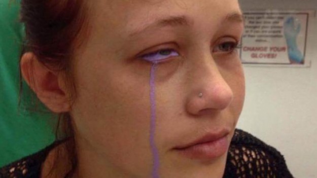 RMF Extra: Chciała mieć oczy jak Popek. To przerażające, co stało się z jej twarzą