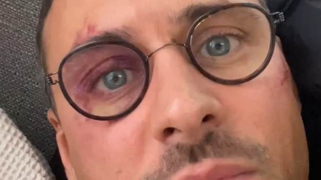 RMF Extra: Mateusz Damięcki wystosował pilną wiadomość do fanów. "Bardzo proszę o pomoc" [WIDEO]