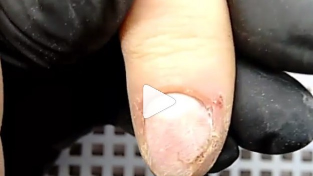 RMF Extra: Metamorfoza z pazurem 