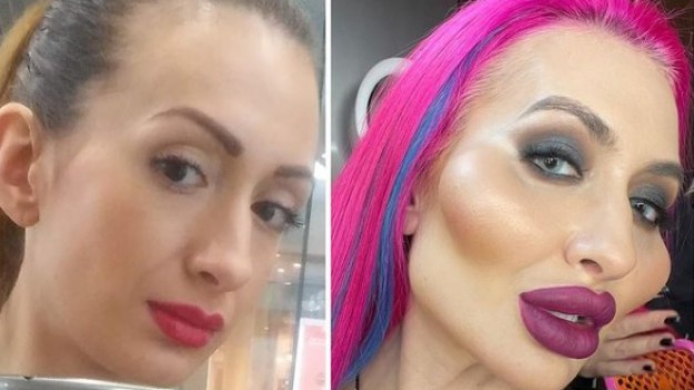 RMF Extra: Anastasia Pokreshchuk ofiarą operacji plastycznych? Jej metamorfoza szokuje [ZDJĘCIA]