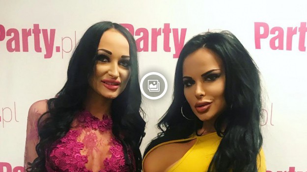 RMF Extra: Esmeralda Godlewska przeszła nieudaną operację plastyczną?! Zobacz to zdjęcie!