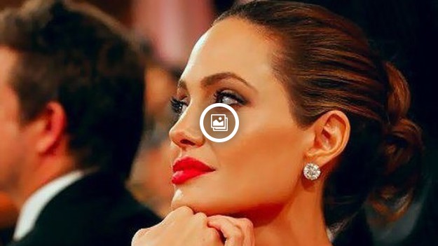 RMF Extra: Chciała wyglądać jak Angelina Jolie. Przeszła 50 operacji i została oszpecona