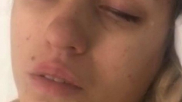 RMF Extra: Koszmarny wypadek wokalistki disco polo. Jej siostra błaga o pomoc!