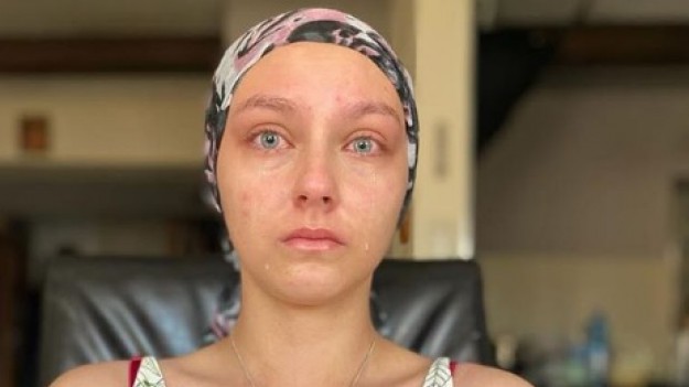 RMF Extra: Ma 18 lat i walczy z guzem mózgu! By ratować Julkę, potrzeba 8 milionów złotych!