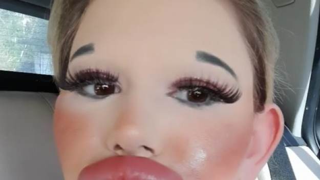 RMF Extra: Powiększyła usta 30 razy. Tak wygląda teraz [FOTO] 