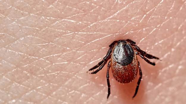 RMF Extra: Jak bezpiecznie usunąć kleszcza? Które miejsca na ciele wybiera najczęściej? [FOTO]