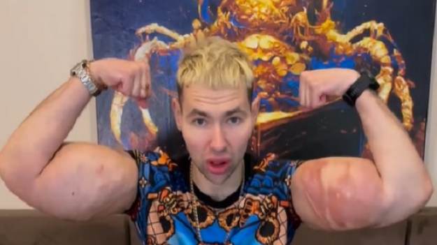 RMF Extra: Lata temu jego bicepsy wybuchły po wstrzykiwaniu oleju. Dziś wygląda zupełnie inaczej [FOTO] 