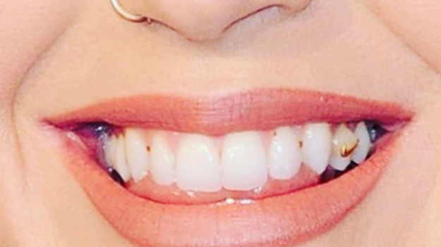 RMF Extra: Katy Perry zaliczyła wpadkę na uroczystej gali. Oto, jak ją skomentowała!