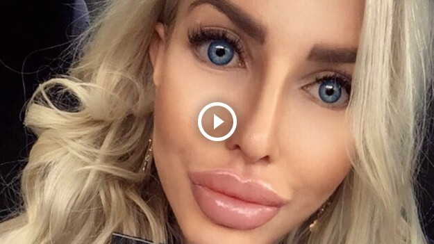 RMF Extra: Anella przed operacjami w teledysku polskiego rapera! Rozpoznalibyście ją?