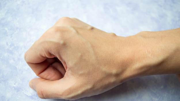 RMF Extra: Masz widoczne żyły na dłoniach? Sprawdź, czy to normalne i kiedy iść do lekarza