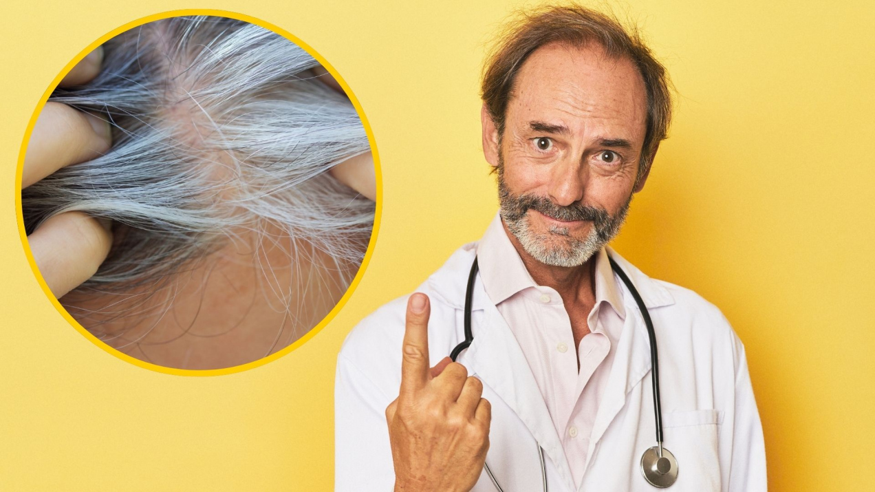 Siwe włosy mogą wskazywać, iż organizm zwalcza nowotwór? Zaskakujące wyniki badań